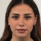Agnesa