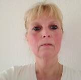 Annick